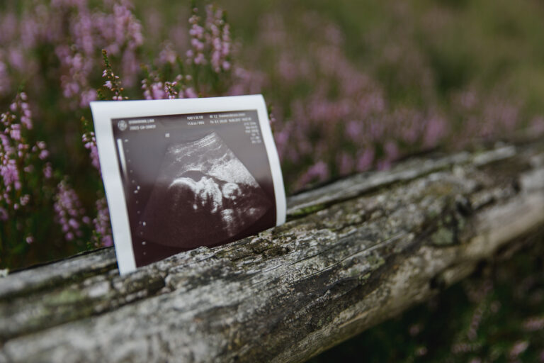 Baby-Ankündigung: Ultraschallbild als Nahaufnahme befestigt an einem Holzzaun in blühender Heidelandschaft